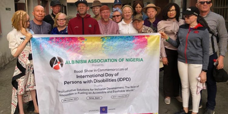 AAN Calls For Better Life For Persons With Albinism, Introduces National Officers