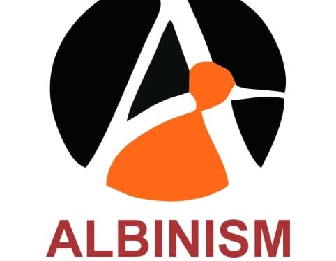 Workers’ Day: Albinism Association Calls For Inclusive Work Environment